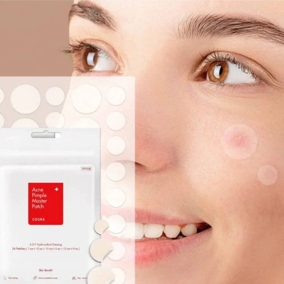 Patch para acné Cosrx aplicado en mejilla de mujer con piel clara y ojos marrones