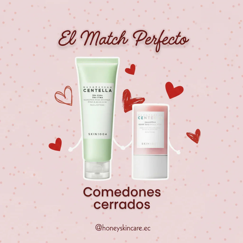 Comedones Cerrados