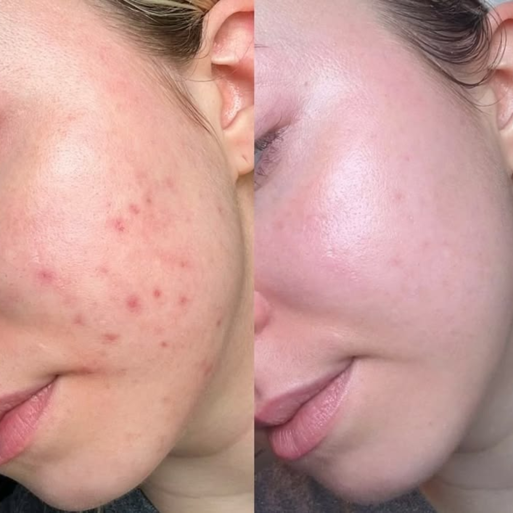 Dr.Althea 345 Relief Serum – Sérum Calmante y Reparador