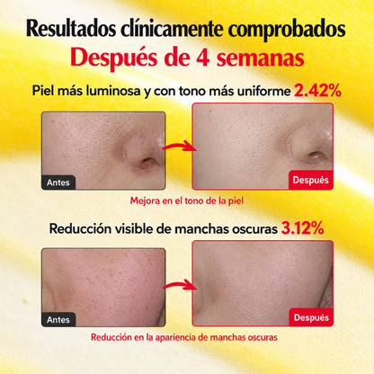 Vitamin Illuminating Serum - Honey SkinCare Ec