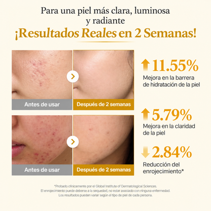 Serum Ácido Kójico Tumeric Niacinamida - Honey SkinCare Ec