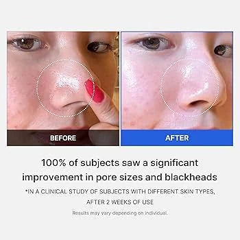 Medicube Zero Pore Pad 2.0 – Pads exfoliantes, 70 discos
